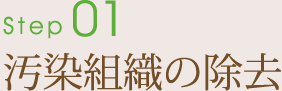 Step1.汚染組織の除去